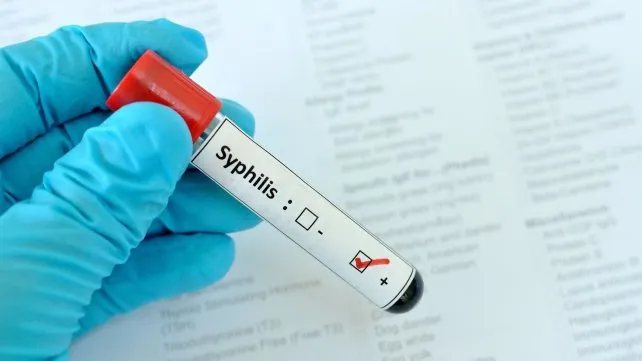 sifilis