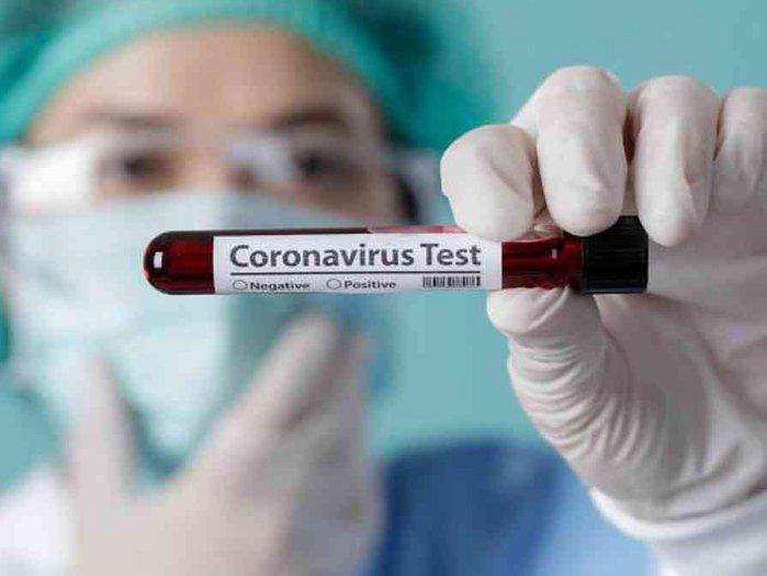 15189-coronavirus8