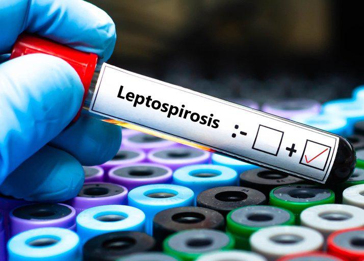 23591-Leptospirosis