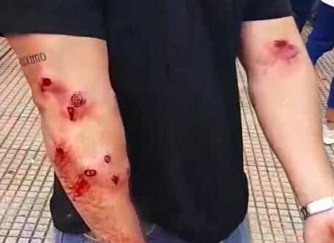 Insfrán y la represión de la protesta social