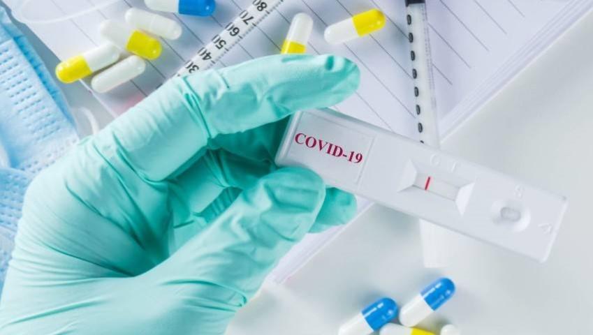 Asi-funcionan-los-test-rapidos-para-la-COVID-19